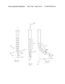 SYSTEM FOR USE IN TREATMENT OF VERTEBRAL FRACTURES diagram and image