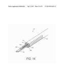 SYSTEM FOR USE IN TREATMENT OF VERTEBRAL FRACTURES diagram and image