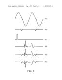 INTERFERENCE REDUCTION AND SIGNAL TO NOISE RATIO IMPROVEMENT FOR     ULTRASOUND CARDIAC ABLATION MONITORING diagram and image