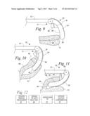 MEDICAL INSTRUMENT AND METHOD OF PERFORMING A SURGICAL PROCEDURE WITH THE     MEDICAL INSTRUMENT diagram and image