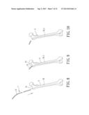 Support instrument with modular intramedullary nail diagram and image