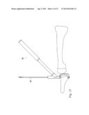 ORTHOPEDIC SUTURE PASSER AND METHOD diagram and image