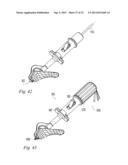 ORTHOPEDIC SUTURE PASSER AND METHOD diagram and image