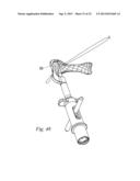 ORTHOPEDIC SUTURE PASSER AND METHOD diagram and image