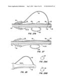 Tissue Separating Catheter Assembly and Method diagram and image