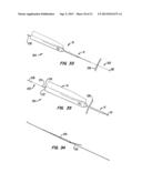 Tissue Separating Catheter Assembly and Method diagram and image