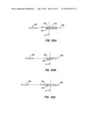 Tissue Separating Catheter Assembly and Method diagram and image