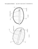 ROBOTIC CATHETER SYSTEM diagram and image