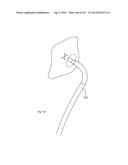 ROBOTIC CATHETER SYSTEM diagram and image