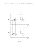 ROBOTIC CATHETER SYSTEM diagram and image