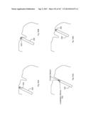 ROBOTIC CATHETER SYSTEM diagram and image