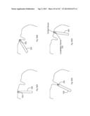 ROBOTIC CATHETER SYSTEM diagram and image