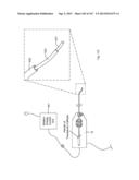 ROBOTIC CATHETER SYSTEM diagram and image