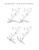 ROBOTIC CATHETER SYSTEM diagram and image