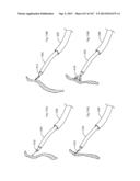 ROBOTIC CATHETER SYSTEM diagram and image