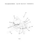 ROBOTIC CATHETER SYSTEM diagram and image