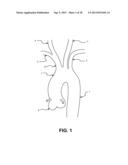 INTRAVASCULAR BLOOD FILTER diagram and image