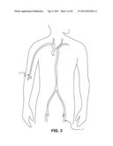 INTRAVASCULAR BLOOD FILTER diagram and image