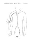 INTRAVASCULAR BLOOD FILTER diagram and image