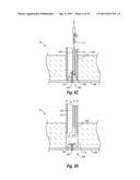 SUTURE SECURING SYSTEMS, DEVICES AND METHODS diagram and image