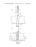 SUTURE SECURING SYSTEMS, DEVICES AND METHODS diagram and image