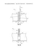 SUTURE SECURING SYSTEMS, DEVICES AND METHODS diagram and image