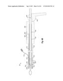 SUTURE SECURING SYSTEMS, DEVICES AND METHODS diagram and image