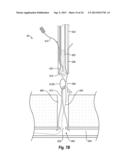 SUTURE SECURING SYSTEMS, DEVICES AND METHODS diagram and image