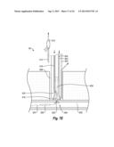 SUTURE SECURING SYSTEMS, DEVICES AND METHODS diagram and image