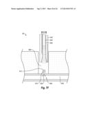 SUTURE SECURING SYSTEMS, DEVICES AND METHODS diagram and image