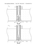 SUTURE SECURING SYSTEMS, DEVICES AND METHODS diagram and image