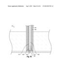 SUTURE SECURING SYSTEMS, DEVICES AND METHODS diagram and image