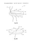 SUTURE SECURING SYSTEMS, DEVICES AND METHODS diagram and image