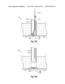 SUTURE SECURING SYSTEMS, DEVICES AND METHODS diagram and image