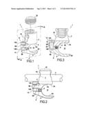 BONE ANCHOR diagram and image