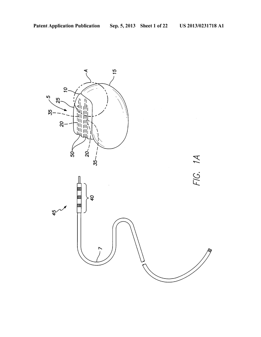 IMPLANTABLE MEDICAL DEVICE HAVING FEEDTHRU ASSEMBLY WITH HEADER SIDE     BUNCHED CONDUCTOR ARRAY AND CAN SIDE LINEAR CONDUCTOR ARRAY - diagram, schematic, and image 02