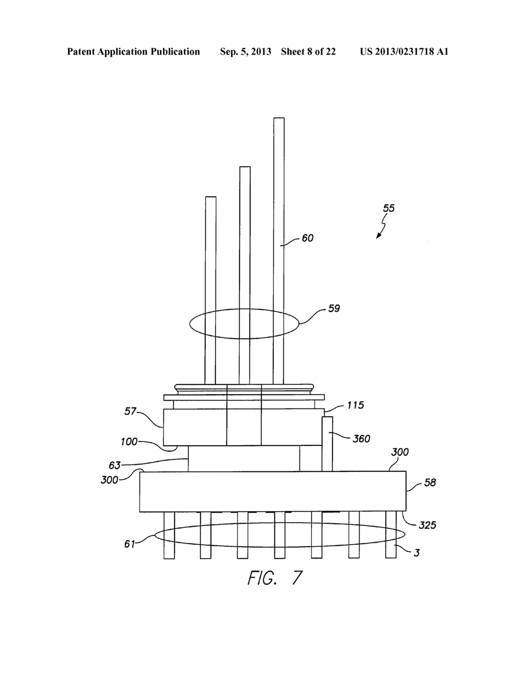 IMPLANTABLE MEDICAL DEVICE HAVING FEEDTHRU ASSEMBLY WITH HEADER SIDE     BUNCHED CONDUCTOR ARRAY AND CAN SIDE LINEAR CONDUCTOR ARRAY - diagram, schematic, and image 09