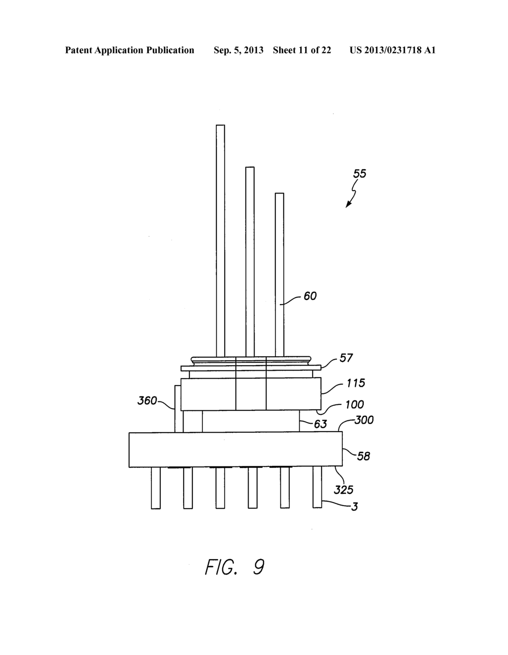 IMPLANTABLE MEDICAL DEVICE HAVING FEEDTHRU ASSEMBLY WITH HEADER SIDE     BUNCHED CONDUCTOR ARRAY AND CAN SIDE LINEAR CONDUCTOR ARRAY - diagram, schematic, and image 12