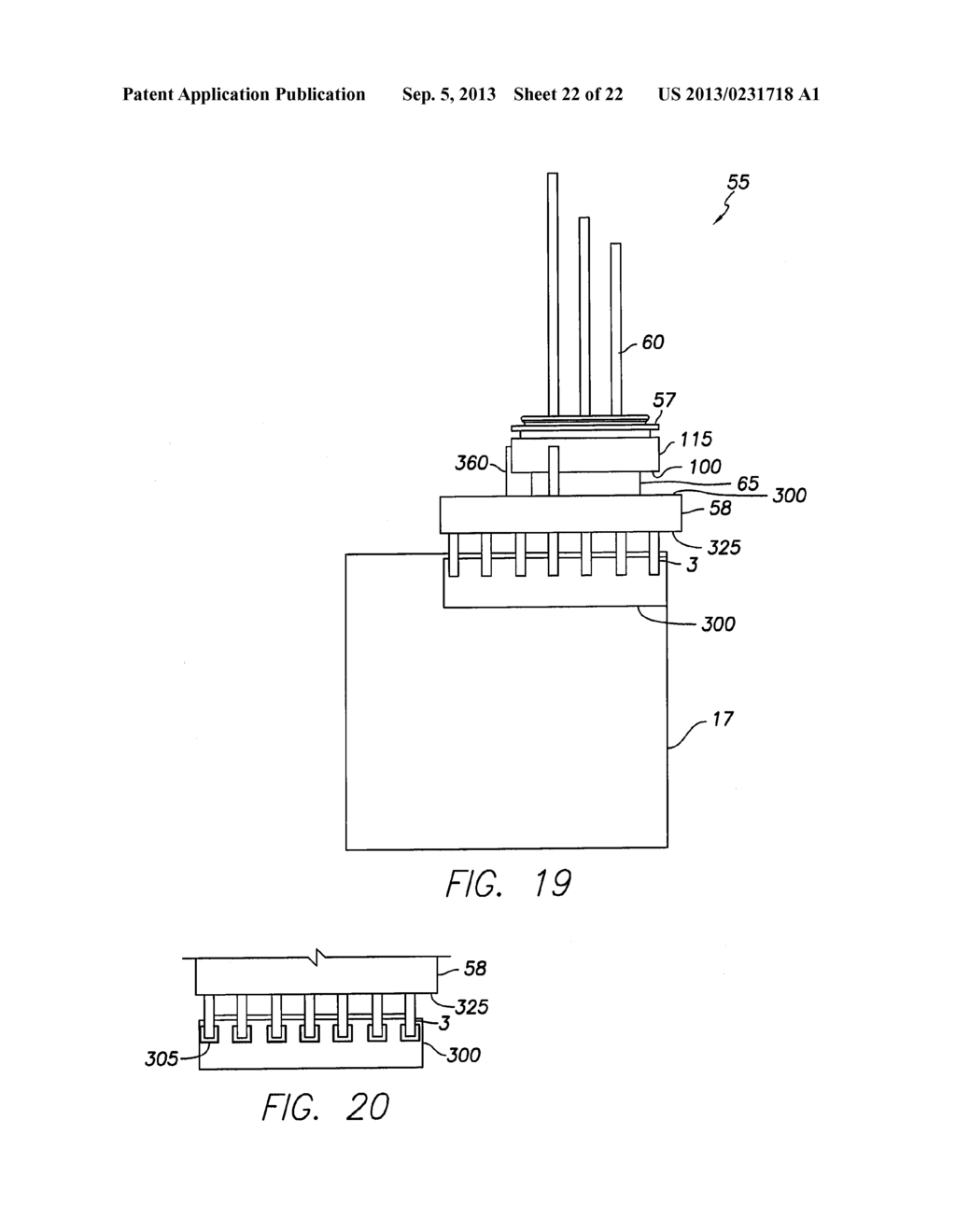 IMPLANTABLE MEDICAL DEVICE HAVING FEEDTHRU ASSEMBLY WITH HEADER SIDE     BUNCHED CONDUCTOR ARRAY AND CAN SIDE LINEAR CONDUCTOR ARRAY - diagram, schematic, and image 23