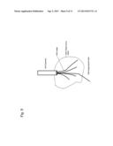 Applications of the Stimulation of Neural Tissue Using Light diagram and image