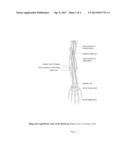 Peripheral Afferent Nerve Stimulation for Treatment of Epilepsy diagram and image