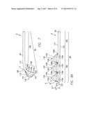 LEAD WITH BIOABSORBABLE METALLIC FIXATION STRUCTURE diagram and image