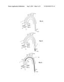 BLOOD VESSEL PROSTHESIS AND DELIVERY APPARATUS diagram and image