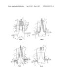 BLOOD VESSEL PROSTHESIS AND DELIVERY APPARATUS diagram and image