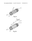 Implantable Graft Assembly and Aneurysm Treatment diagram and image