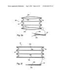 Implantable Graft Assembly and Aneurysm Treatment diagram and image