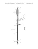 Catheter Delivery System For Stent Valve diagram and image