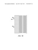 INTRA-ATRIAL IMPLANTS MADE OF NON-BRAIDED MATERIAL diagram and image