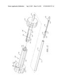 INTRA-ATRIAL IMPLANTS MADE OF NON-BRAIDED MATERIAL diagram and image