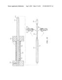 INTRA-ATRIAL IMPLANTS MADE OF NON-BRAIDED MATERIAL diagram and image